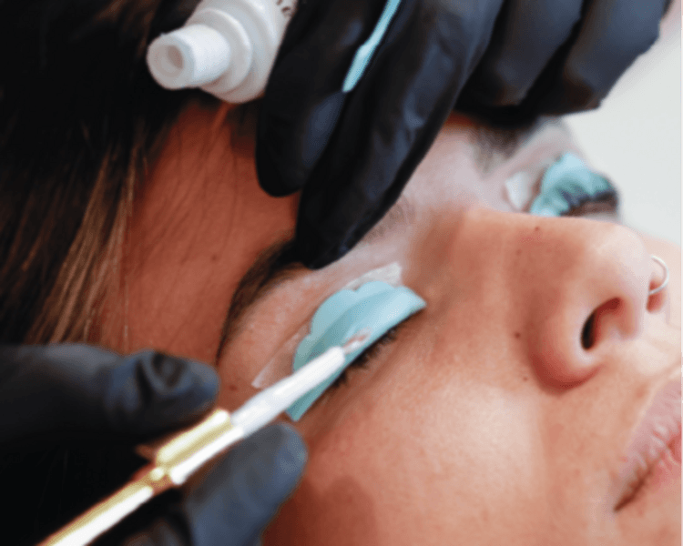Botox Reconstructivo en pestañas