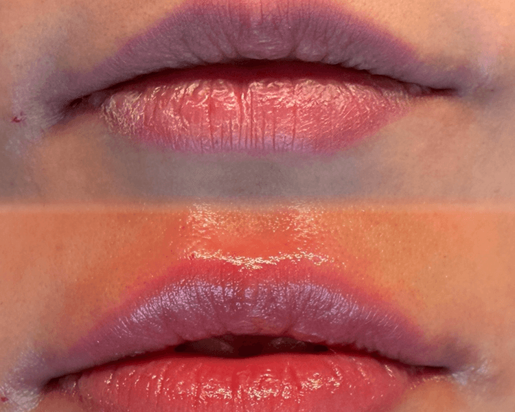 Abono labios 👄