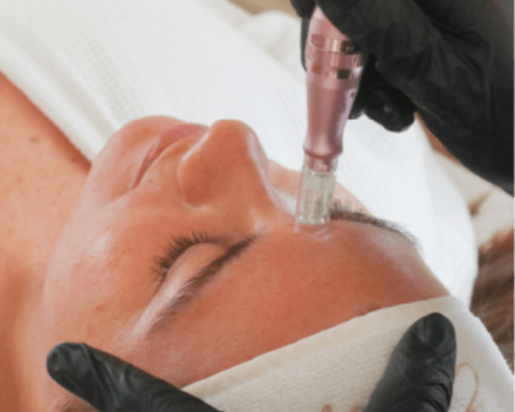 Dermapen