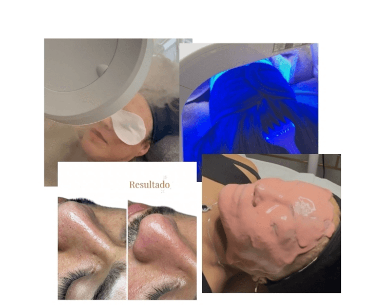 Limpieza Facial Premium
