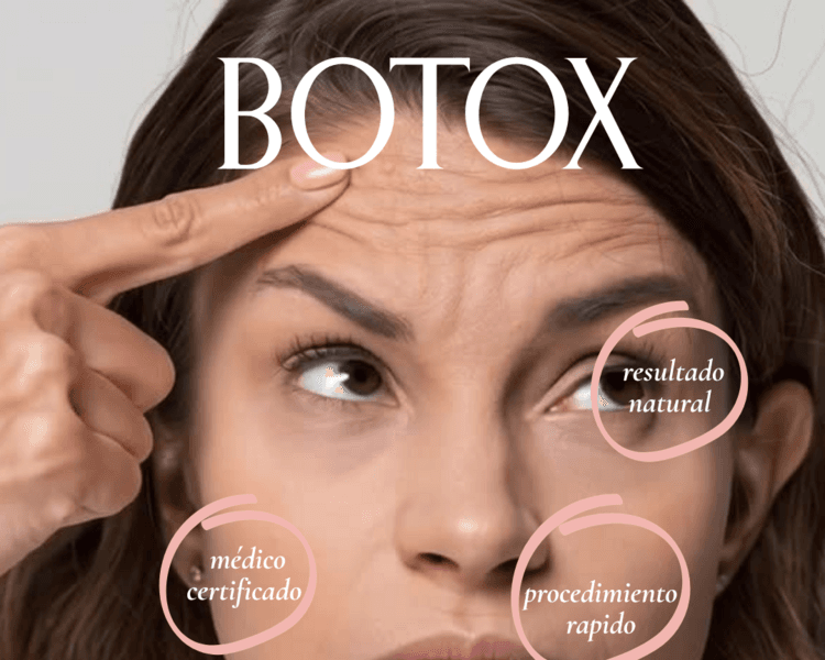 BOTOX FACIAL SUPERIOR - ALLERGAN PROMO