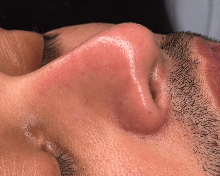Limpieza facial