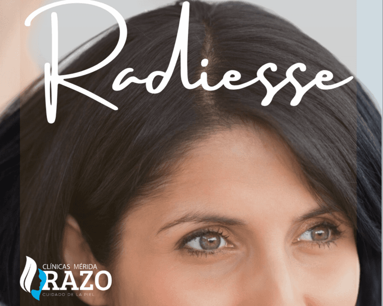 BIOESTIMULADOR RADIESSE