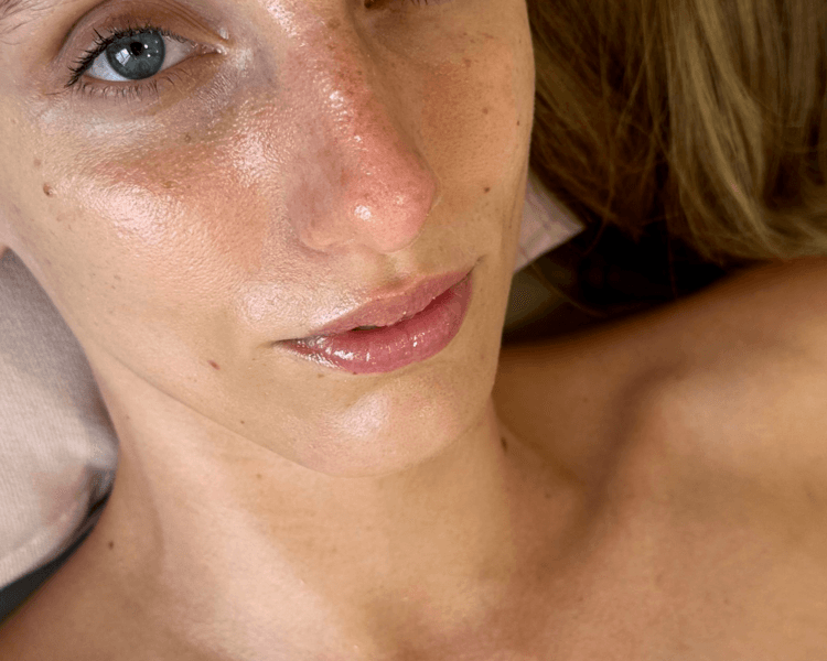 FACIAL REFRESH
