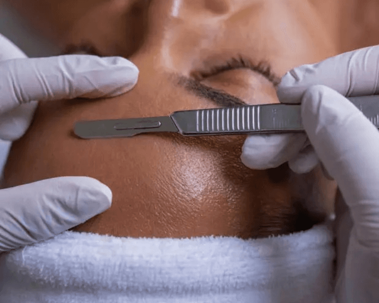 Higiene + dermaplaning con bisturi+hidratación