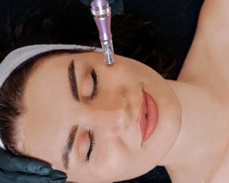 Limpieza Facial + Dermapen