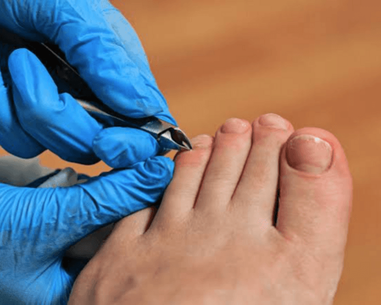 Pedicuria / Podologia