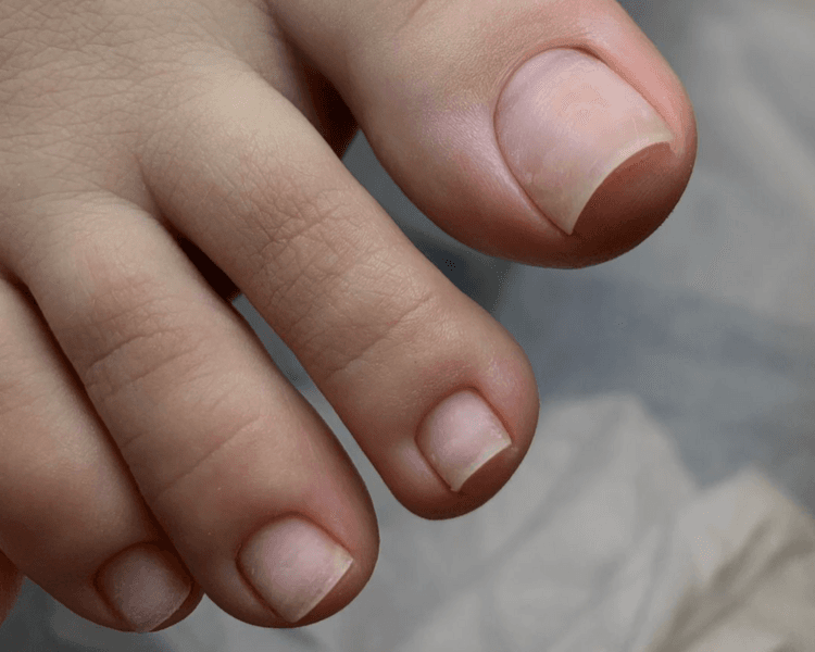 Sólo pedicura profunda