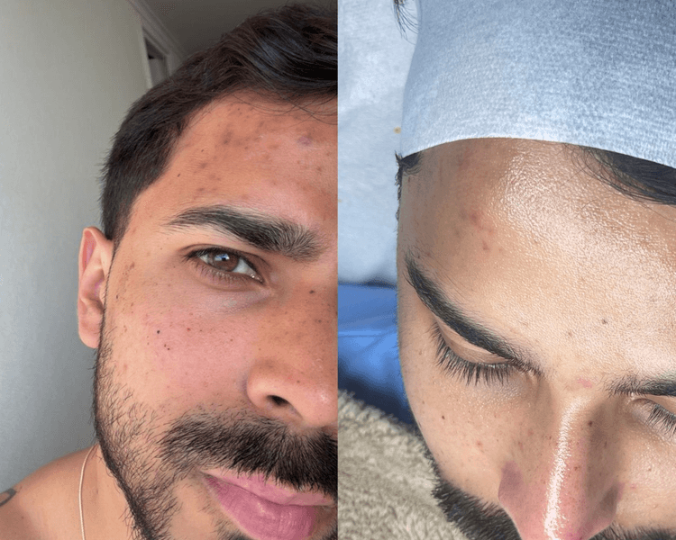 PEELING FACIAL DE ALGAS DESCAMATIVO