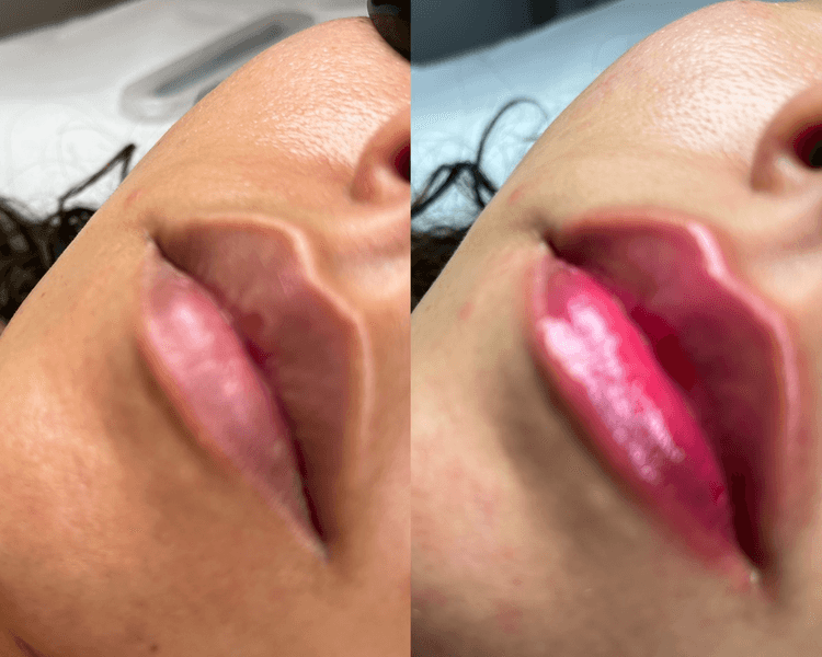 💋 HYDRALIPS ✨