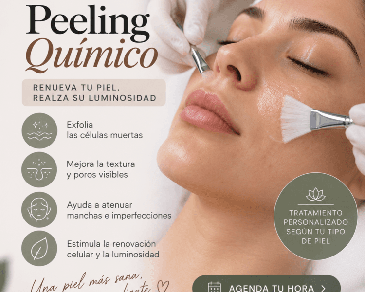 Peeling Quimico