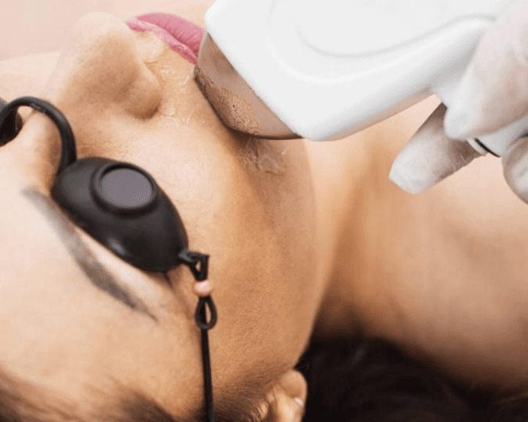 Protocolo facial para HIRSUTISMO