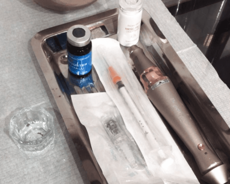 Microneedling