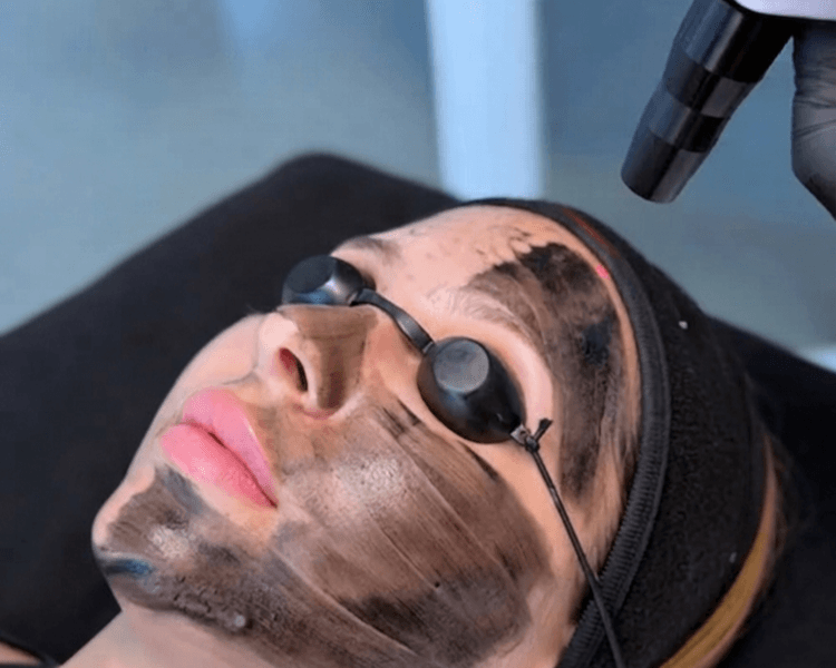 Hollywood Peeling