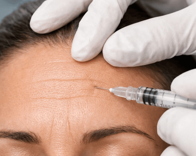 BOTOX 3 ZONAS