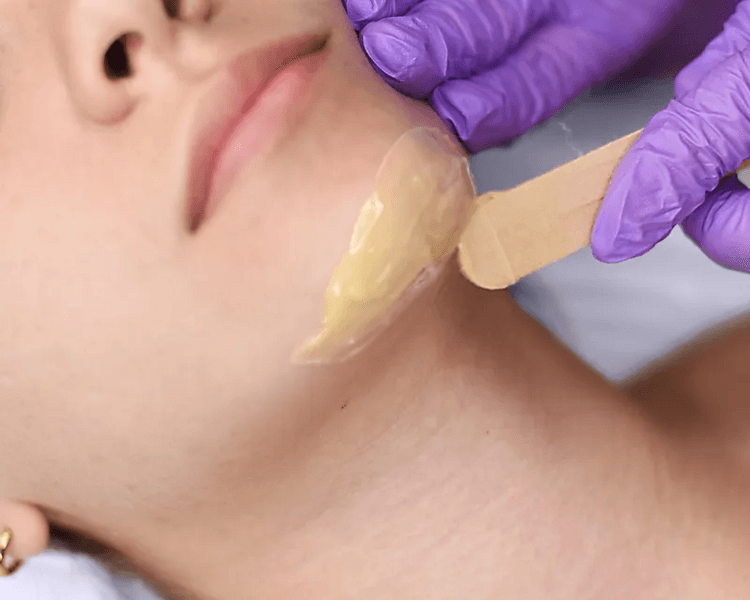 Depilacion de Barbilla