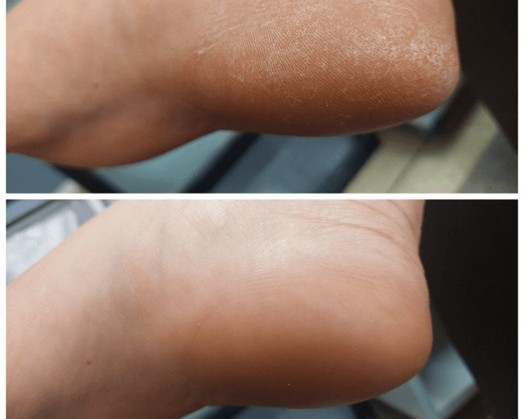 Dry Pedicure Prive