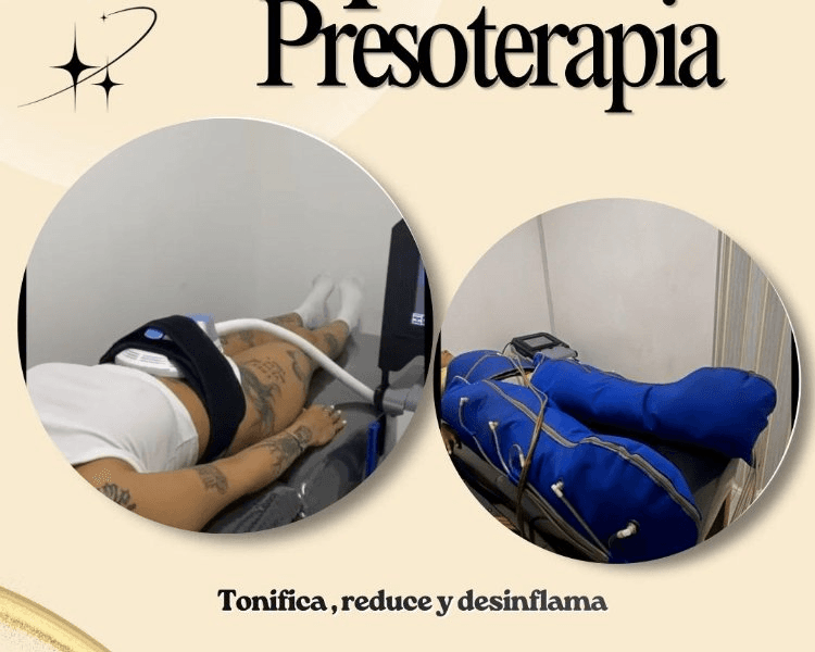 MIO UP + PREOSTERAPIA 1 zona