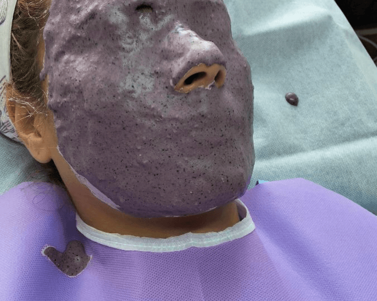 Limpieza Facial