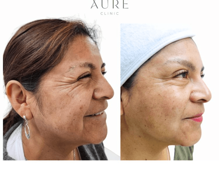 Evaluación Facial General