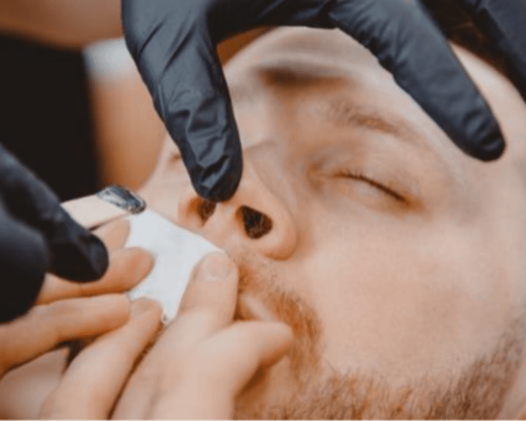Depilación Nasal y Orejas