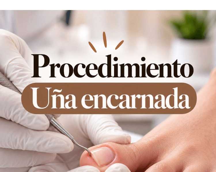 Uña encarnada