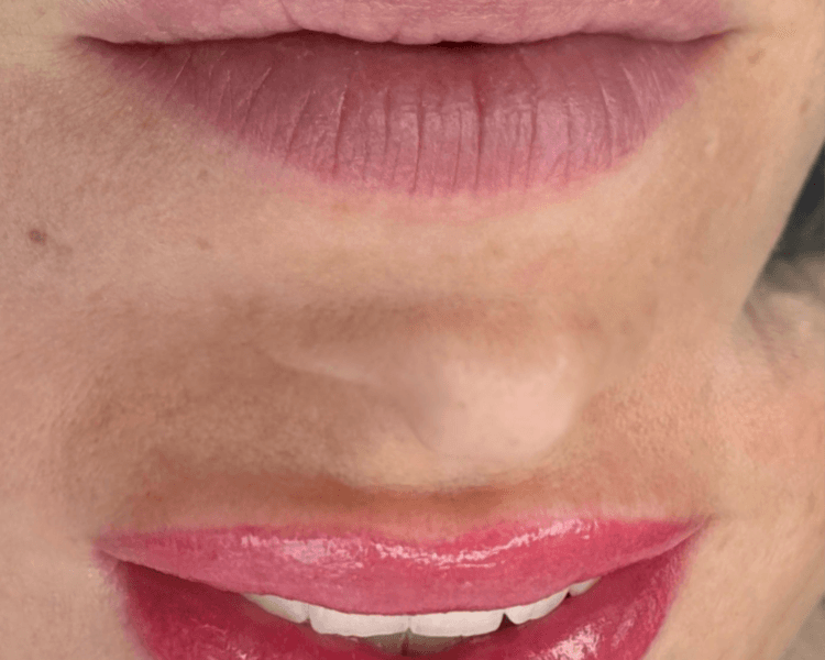 Micropigmentación de Labios