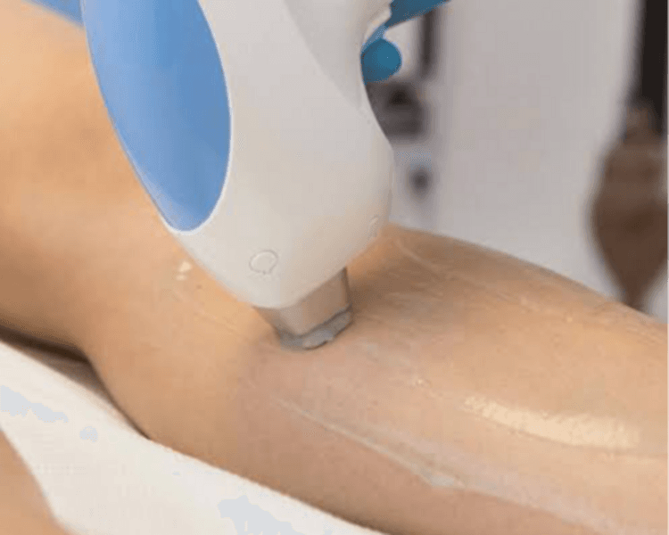 Triláser Piernas completas 8 sesiones