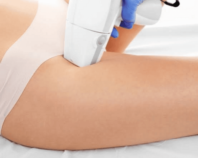 Triláser Axilas+ Rebaje completo 8 sesiones