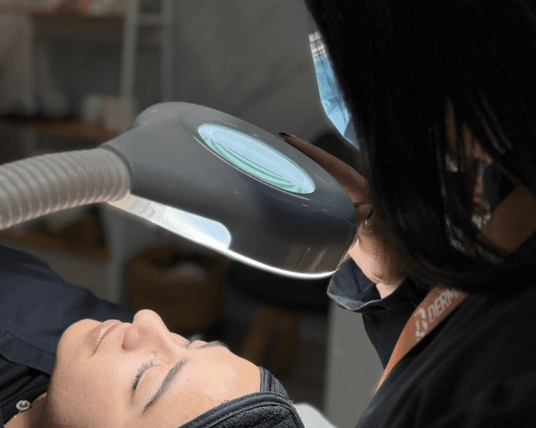 Evaluación Facial – Radiofrecuencia y Reafirmación