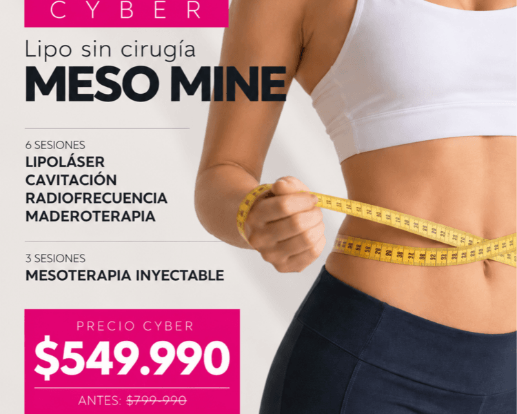 PLAN REDUCTIVO MESO MINE