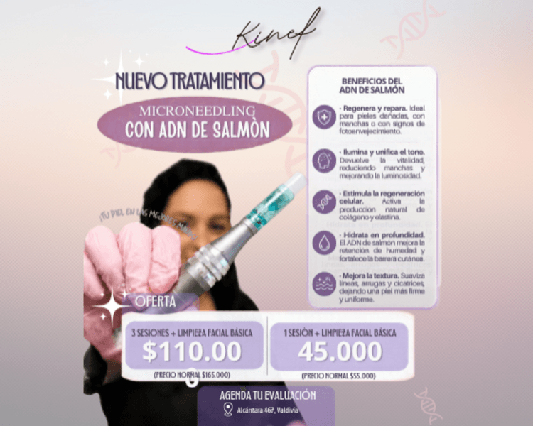 PROMOCIÓN 3 SESIONES DE ADN DE SALMÓN + LIMPIEZA FACIAL BÁSICA CON MICRONEEDLING