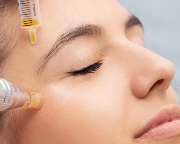 PRP Rostro y cuello