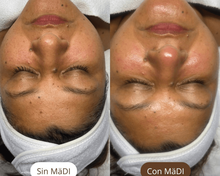 G. Facial Revitalizante