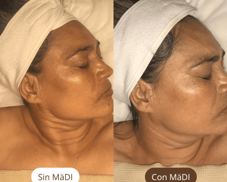 F. Facial Reafirmante
