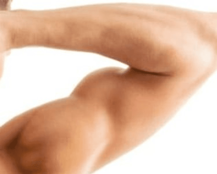 Depilación Láser Hombre: Brazos (6 sesiones)