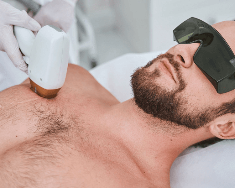 Depilación Láser Hombre: Pecho (6 sesiones)