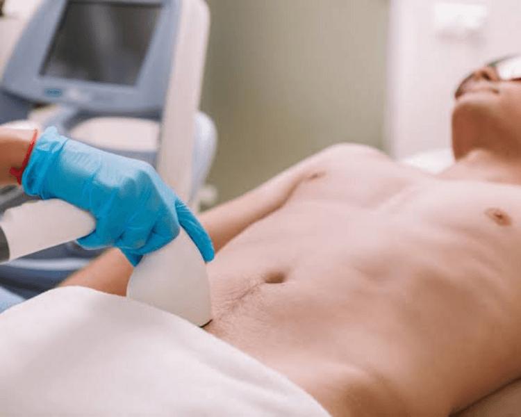 Depilación Láser Hombre: Zona intima - Full (6 sesiones)