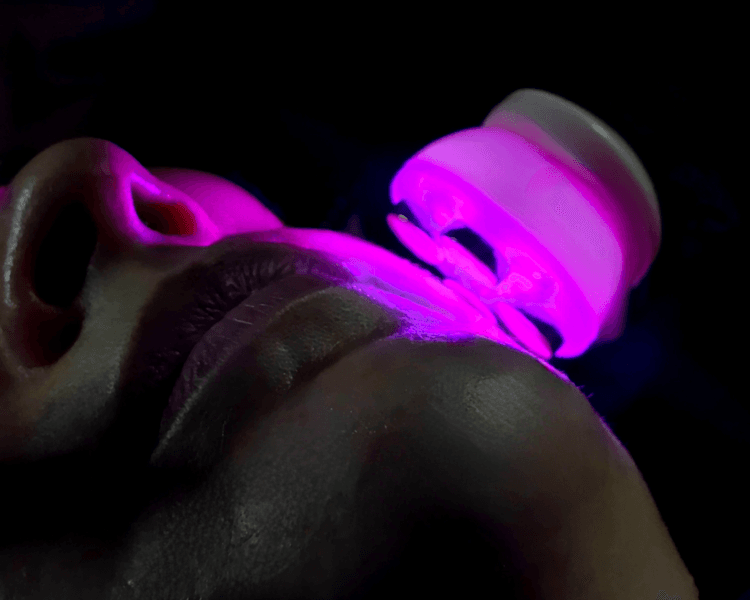 Facial clínica ( Hydrafacial) para piel seca 🧖🏻♀️