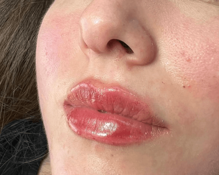 Armonización de labios