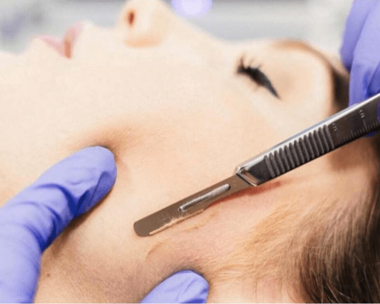 Dermaplaning Facial