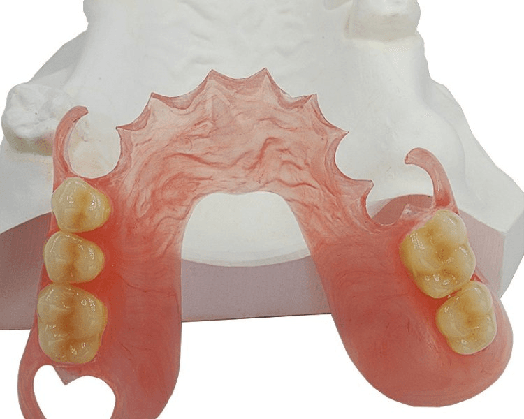 PROTESIS INYECTADA