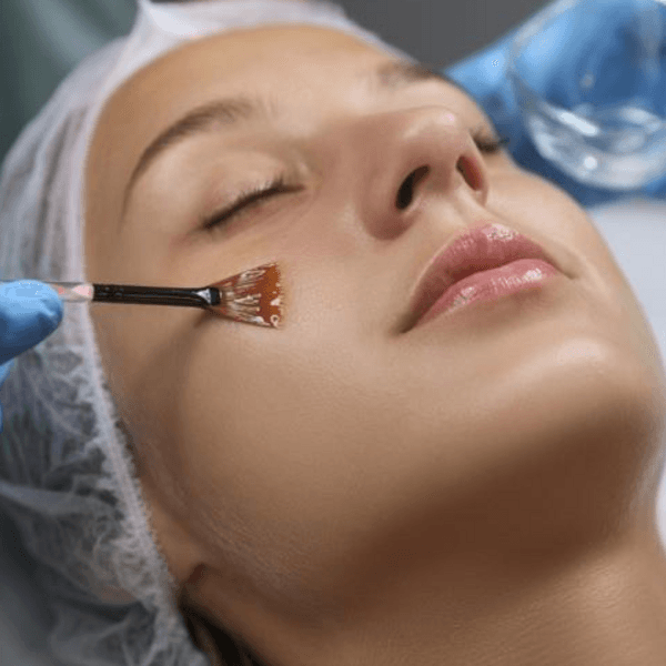 Limpieza de cutis profunda con Peeling (EFECTIVO $66.000)