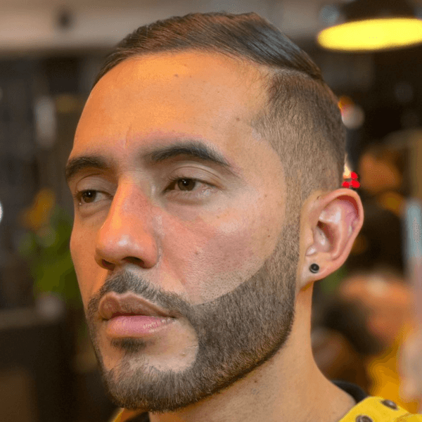 PIGMENTACION DE BARBA