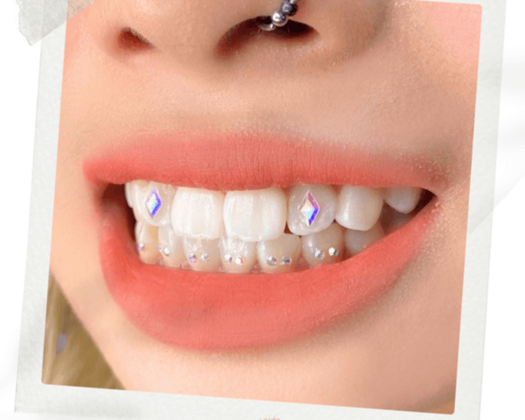 Joyería dental Full Diseños