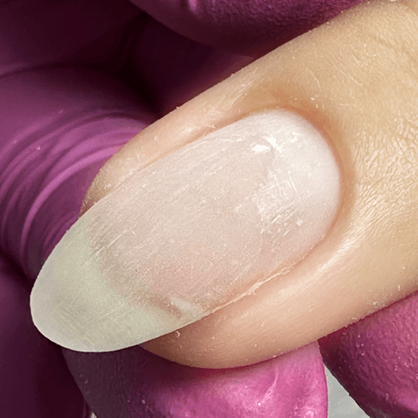 Reparación de uña rota (1 uña)