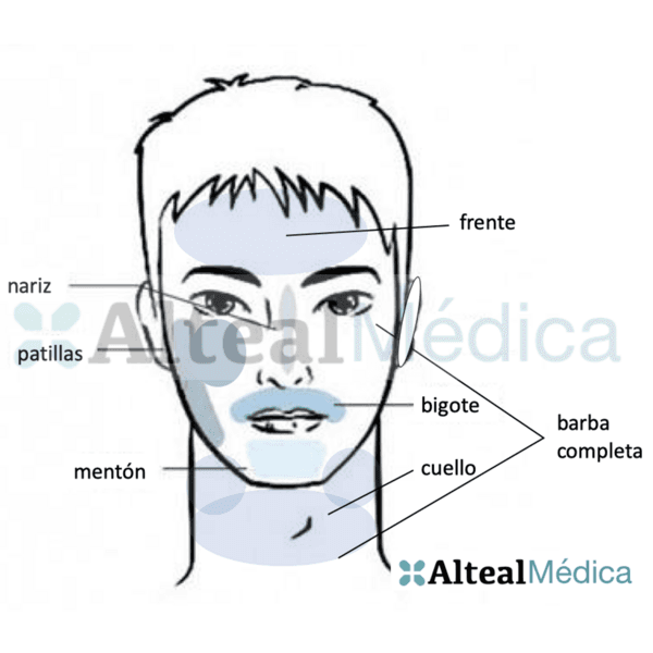 MEDIA CARA (1 sesión) Depilación Láser Diodo