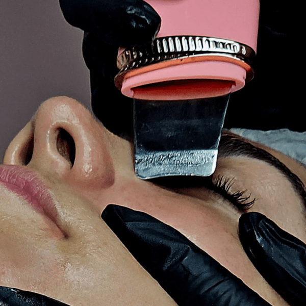 Facial clínica ( Hydrafacial ) para piel grasa 🧖🏻♀️