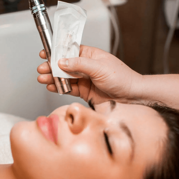 Limpieza Facial Profunda con Punta de Diamante + (Dermapen).