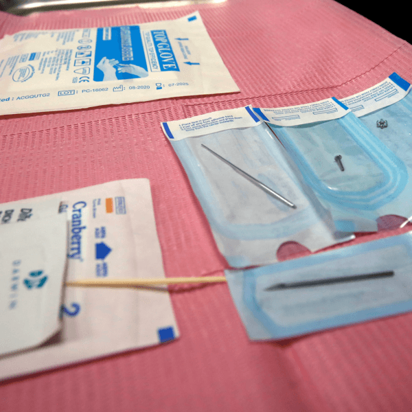 Control externo (revisemos tu perforación)